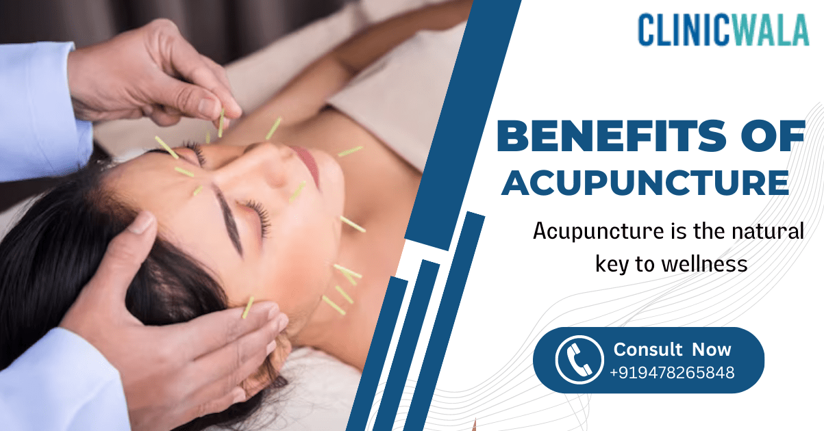 Balancing Your Body and Mind with Acupuncture Therapy