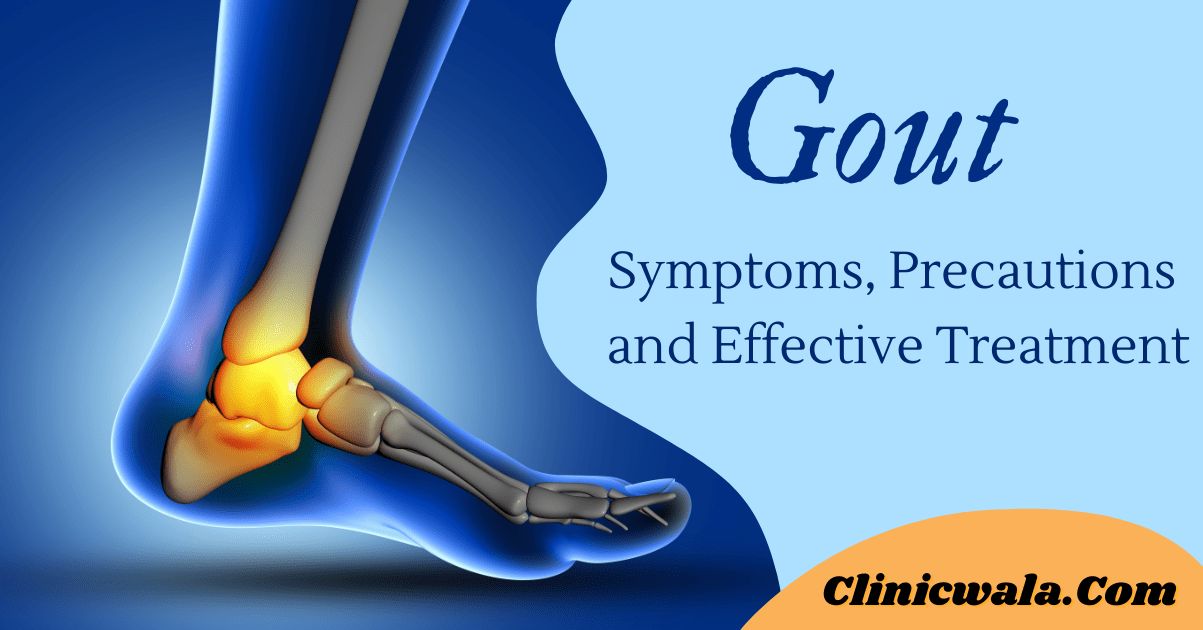 What You Need to Know About Gout Disease in Order to Manage Your Symptoms