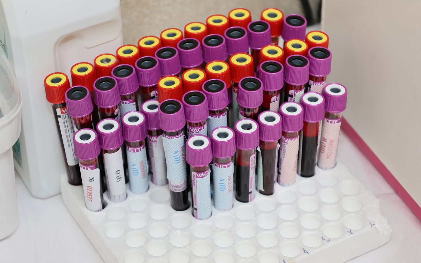 Capped blood sample vials in a laboratory rack